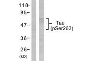 Western Blotting (WB) image for anti-Microtubule-Associated Protein tau (MAPT) (pSer262) antibody (ABIN2888545) (MAPT Antikörper  (pSer262))