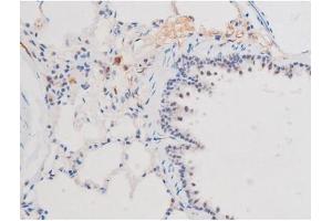 ABIN6267508 at 1/200 staining Rat lung tissue sections by IHC-P. (STAT1 Antikörper  (pSer727))