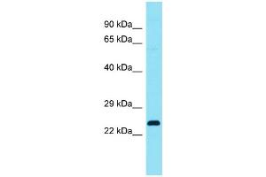 Host: Rabbit Target Name: C4orf45 Sample Type: Fetal Lung lysates Antibody Dilution: 1. (C4ORF45 Antikörper  (C-Term))
