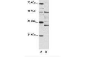 Image no. 1 for anti-Forkhead Box N2 (FOXN2) (N-Term) antibody (ABIN6736146) (FOXN2 Antikörper  (N-Term))