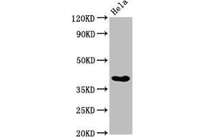 Western Blot Positive WB detected in: Hela whole cell lysate All lanes: NKX2-3 antibody at 3. (NK2 Homeobox 3 Antikörper  (AA 52-148))