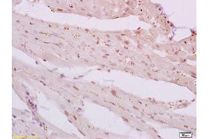 Formalin-fixed and paraffin embedded rat heart tissue labeled with Anti-Phospho-VASP(Ser239) Polyclonal Antibody, Unconjugated (ABIN746753) at 1:200 followed by conjugation to the secondary antibody and DAB staining