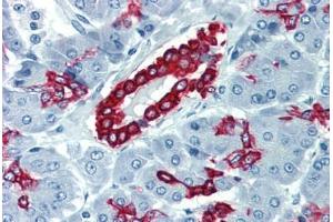 Pancreas, Human: Formalin-Fixed, Paraffin-Embedded (FFPE) (Cytokeratin 19 Antikörper  (C-Term))
