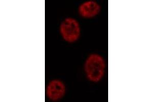 ABIN6269286 staining Hep G2 cells by IF/ICC. (Ataxin 1 Antikörper  (C-Term))