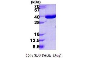 Image no. 1 for Annexin A10 (ANXA10) (AA 1-324) protein (His tag) (ABIN667682) (Annexin a10 Protein (AA 1-324) (His tag))