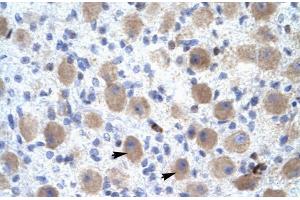 Rabbit Anti-OR13C9 Antibody Catalog Number: ARP31898 Paraffin Embedded Tissue: Human Brain Cellular Data: Neural Cells Antibody Concentration: 4. (OR13C9 Antikörper  (Middle Region))
