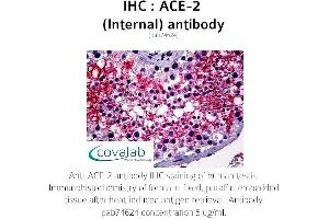 Image no. 1 for anti-Angiotensin I Converting Enzyme 2 (ACE2) (Internal Region) antibody (ABIN5693460) (ACE2 Antikörper  (Internal Region))