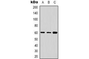 Western blot analysis of Cytochrome P450 24A1 expression in Jurkat (A), A431 (B), HepG2 (C) whole cell lysates. (CYP24A1 Antikörper  (C-Term))