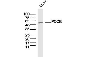 Mouse liver lysates probed with PCCB Polyclonal Antibody, Unconjugated  at 1:300 dilution and 4˚C overnight incubation. (PCCB Antikörper  (AA 321-420))