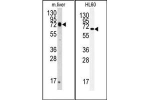 Image no. 1 for anti-Heat Shock 70kDa Protein 5 (Glucose-Regulated Protein, 78kDa) (HSPA5) antibody (ABIN356850) (GRP78 Antikörper)