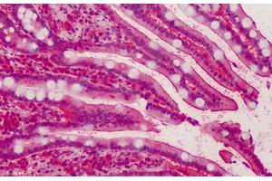 Human Small Intestine: Formalin-Fixed, Paraffin-Embedded (FFPE) (MPP5 Antikörper  (AA 174-187))