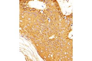(ABIN6242763 and ABIN6577904) staining SNCA in Human skin tissue sections by Immunohistochemistry (IHC-P - paraformaldehyde-fixed, paraffin-embedded sections). (SNCA Antikörper  (C-Term))