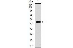 Western Blotting (WB) image for anti-RAB4A, Member RAS Oncogene Family (RAB4A) antibody (ABIN1108812) (Rab4 Antikörper)