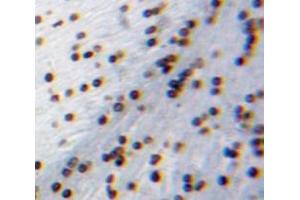Used in DAB staining on fromalin fixed paraffin-embedded Brain tissue (CIDEA Antikörper  (AA 1-219))