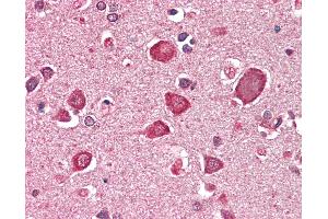 Anti-GABRA6 antibody IHC staining of human brain, cortex. (GABRA6 Antikörper  (AA 15-26))