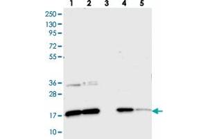 Western blot analysis of Lane 1: RT-4, Lane 2: U-251 MG, Lane 3: Human Plasma, Lane 4: Liver, Lane 5: Tonsil with CNPY2 polyclonal antibody . (CNPY2/MSAP Antikörper)
