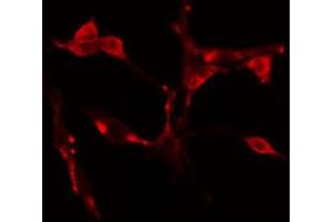 ABIN6274617 staining Hela cells by IF/ICC. (CDCA7 Antikörper  (Internal Region))