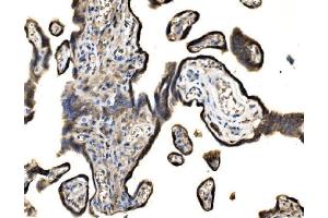 IHC analysis of SND1 using anti-SND1 antibody (ABIN7600527). (SND1 Antikörper  (AA 20-204))