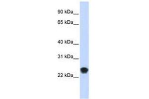 Image no. 1 for anti-FK506 Binding Protein 11, 19 KDa (FKBP11) (AA 35-84) antibody (ABIN6740999) (FKBP11 Antikörper  (AA 35-84))