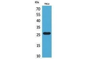 Western Blotting (WB) image for anti-CD302 (CD302) (Internal Region) antibody (ABIN3178489) (DCL1 Antikörper  (Internal Region))