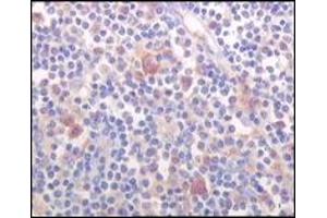 Immunohistochemistry (IHC) image for anti-Bruton Agammaglobulinemia tyrosine Kinase (BTK) (truncated) antibody (ABIN2464023) (BTK Antikörper  (truncated))
