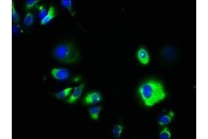 Immunofluorescence staining of MCF-7 cells with ABIN7147319 at 1:133, counter-stained with DAPI. (GPA33 Antikörper  (AA 22-235))