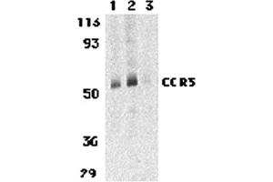 Western Blotting (WB) image for anti-Chemokine (C-C Motif) Receptor 3 (CCR3) (C-Term) antibody (ABIN1030329) (CCR3 Antikörper  (C-Term))