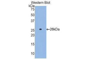 Western Blotting (WB) image for anti-Glutamate-Cysteine Ligase, Catalytic Subunit (GCLC) (AA 429-637) antibody (ABIN1858974) (GCLC Antikörper  (AA 429-637))