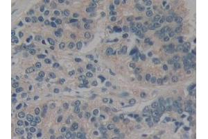 Immunohistochemistry (IHC) image for anti-Caspase Recruitment Domain Family, Member 9 (CARD9) (AA 26-283) antibody (ABIN7443479)
