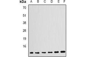 Western blot analysis of GABARAP expression in HepG2 (A), Jurkat (B), PC12 (C), mouse kidney (D), mouse brain (E), rat kidney (F) whole cell lysates. (GABARAP Antikörper)