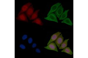 ABIN7096448 and ABIN7100512 staining Hela cells(45 min of heat-shock treatment) by IF/ICC. (TRIM47 Antikörper)
