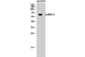 Western Blotting (WB) image for anti-Synaptotagmin Binding, Cytoplasmic RNA Interacting Protein (SYNCRIP) (Internal Region) antibody (ABIN3185069) (SYNCRIP Antikörper  (Internal Region))