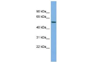 WB Suggested Anti-AGXT2L1 Antibody Titration:  0. (AGXT2L1 Antikörper  (Middle Region))