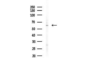 Western blot analysis of lysates from HUVEC cells(starvation,24h treatment), using ZNF497 Antibody at 1/1000 dilution.