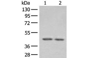 Western blot analysis of 293T cell lysates using ILKAP Polyclonal Antibody at dilution of 1:800 (ILKAP Antikörper)