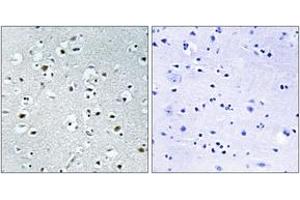 Immunohistochemistry (IHC) image for anti-Peroxisome Proliferator-Activated Receptor Gamma, Coactivator-Related 1 (PPRC1) (AA 1609-1658) antibody (ABIN1535161)