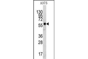 Western blot analysis of anti-KREMEN1 Antibody (N-term) (ABIN391859 and ABIN2841690) in  cell line lysates (35 μg/lane). (KREMEN1 Antikörper  (N-Term))
