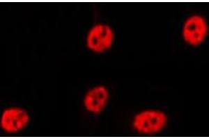 ABIN6269236 staining Hela by IF/ICC. (p21 Antikörper  (C-Term))