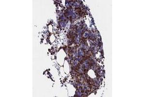 Immunohistochemical staining of human bone marrow with TYROBP polyclonal antibody  shows strong cytoplasmic positivity in hematopoietic cells. (TYROBP Antikörper)