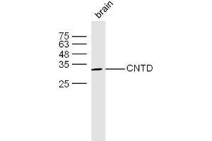 Mouse bone lysates probed with CNTD Polyclonal Antibody, unconjugated  at 1:300 overnight at 4°C followed by a conjugated secondary antibody at 1:10000 for 60 minutes at 37°C. (CNTD1 Antikörper)