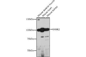 Western blot analysis of extracts of various cell lines, using K antibody (ABIN7268147) at 1:1000 dilution. (KANK2 Antikörper  (AA 1-300))