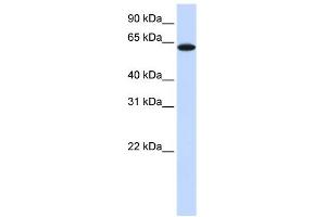 TYRP1 antibody used at 1 ug/ml to detect target protein. (Tyrosinase-Related Protein 1 Antikörper  (Middle Region))
