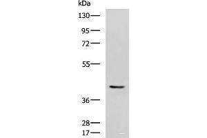 Western blot analysis of Mouse heart tissue lysate using STK32A Polyclonal Antibody at dilution of 1:1000