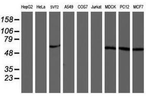 Image no. 1 for anti-V-Akt Murine Thymoma Viral Oncogene Homolog 1 (AKT1) antibody (ABIN1496559) (AKT1 Antikörper)