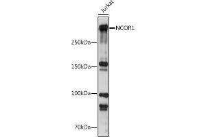 Western blot analysis of extracts of Jurkat cells, using NCOR1 antibody (ABIN6130574, ABIN6144420, ABIN6144421 and ABIN6222831) at 1:500 dilution. (NCOR1 Antikörper  (AA 1-200))