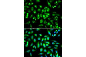 Immunofluorescence analysis of MCF-7 cells using CHRM2 antibody (ABIN5970748). (Muscarinic Acetylcholine Receptor M2 Antikörper)