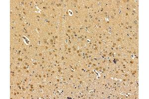 ABIN7095973 and ABIN7100035 at 1/100 staining rat brain tissue by IHC-P. (CMAS Antikörper)