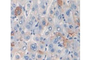 Used in DAB staining on fromalin fixed paraffin- embedded Kidney tissue (PZP Antikörper  (AA 1246-1495))