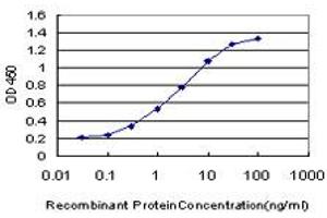 Detection limit for recombinant GST tagged FGFR1 is approximately 0. (FGFR1 Antikörper  (AA 31-150))