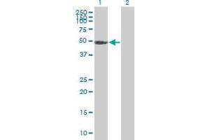 Western Blot analysis of PGS1 expression in transfected 293T cell line by PGS1 MaxPab polyclonal antibody. (PGS1 Antikörper  (AA 1-447))